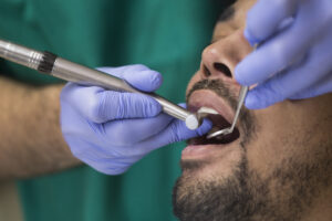 Male patient getting dental treatment after conscious sedation