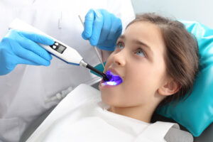 Young girl patient having dental sealant cured with UV