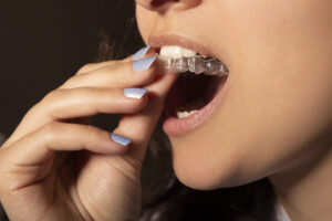 Woman putting on Invisalign