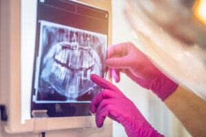 Dentist looking at xray in office